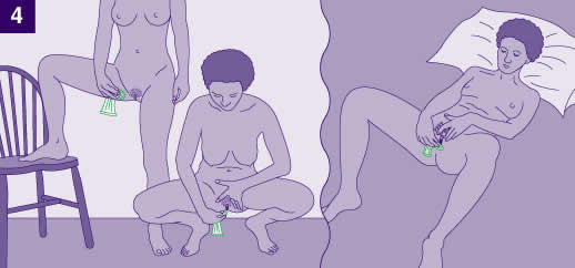 Gambar kondom wanita 4