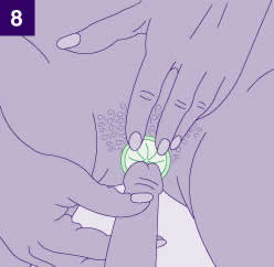 Gambar kondom wanita 8